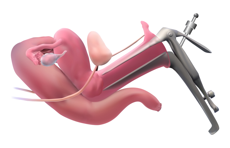 FAQs about Colposcopy - 52 Stirs Lounge